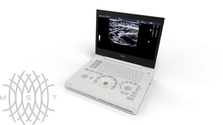 Портативная ультразвуковая система GE HealthCare Logiq e