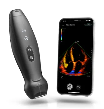 УЗИ аппарат Mindray TE Air