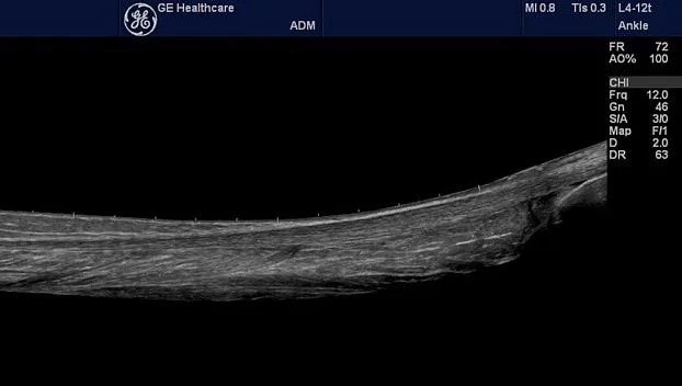 Клинические изображения Портативная ультразвуковая система GE HealthCare Logiq e
