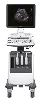 УЗИ аппарат НПО Сканер РуСкан 50