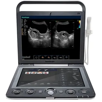 Sonoscape S9 ультразвуковой аппарат