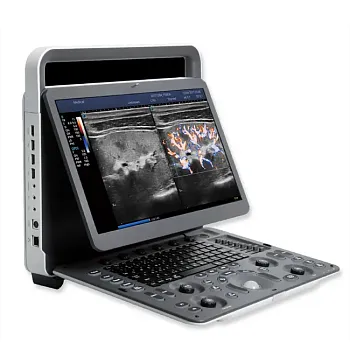 Sonoscape E2 ультразвуковой аппарат